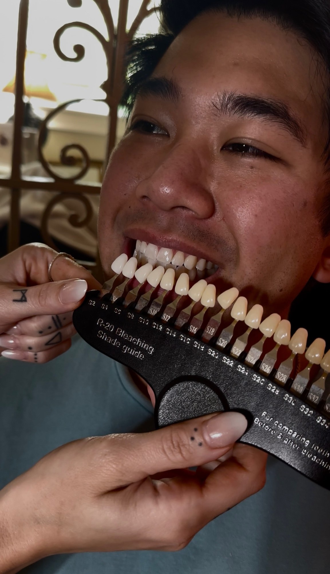 Professional Whitening vs Stri, cover — The Bronze Lily, St. Petersburg, FL
