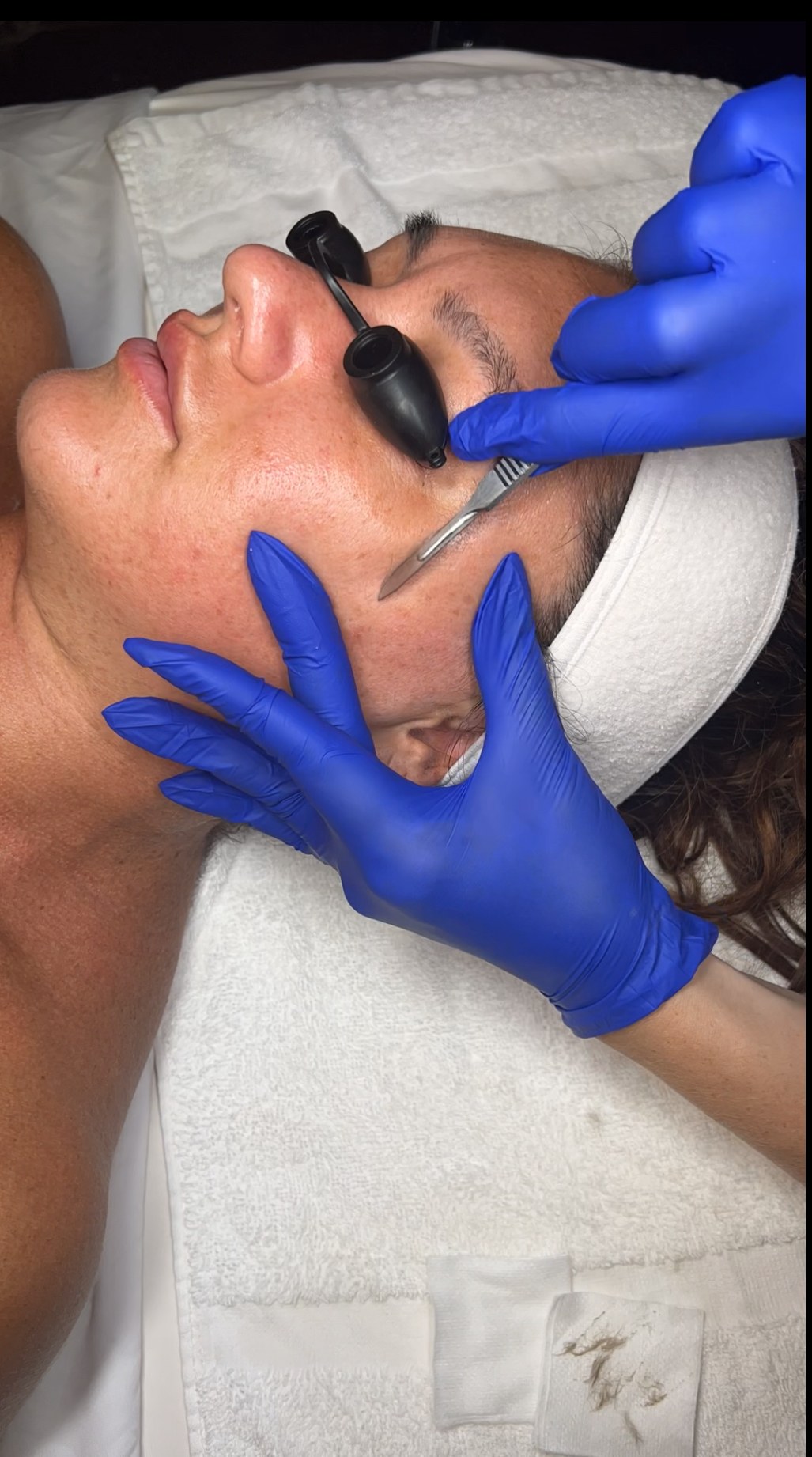 Three resurfacing treatments, decoded — — The Bronze Lily, St. Petersburg, FL